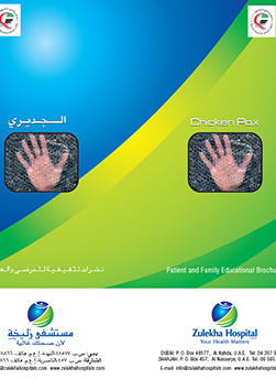 https://www.zulekhahospitals.com/uploads/leaflets_cover/16What-is-chickenpox.jpg