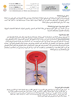 https://www.zulekhahospitals.com/uploads/leaflets_cover/32TURBT-arabic.jpg